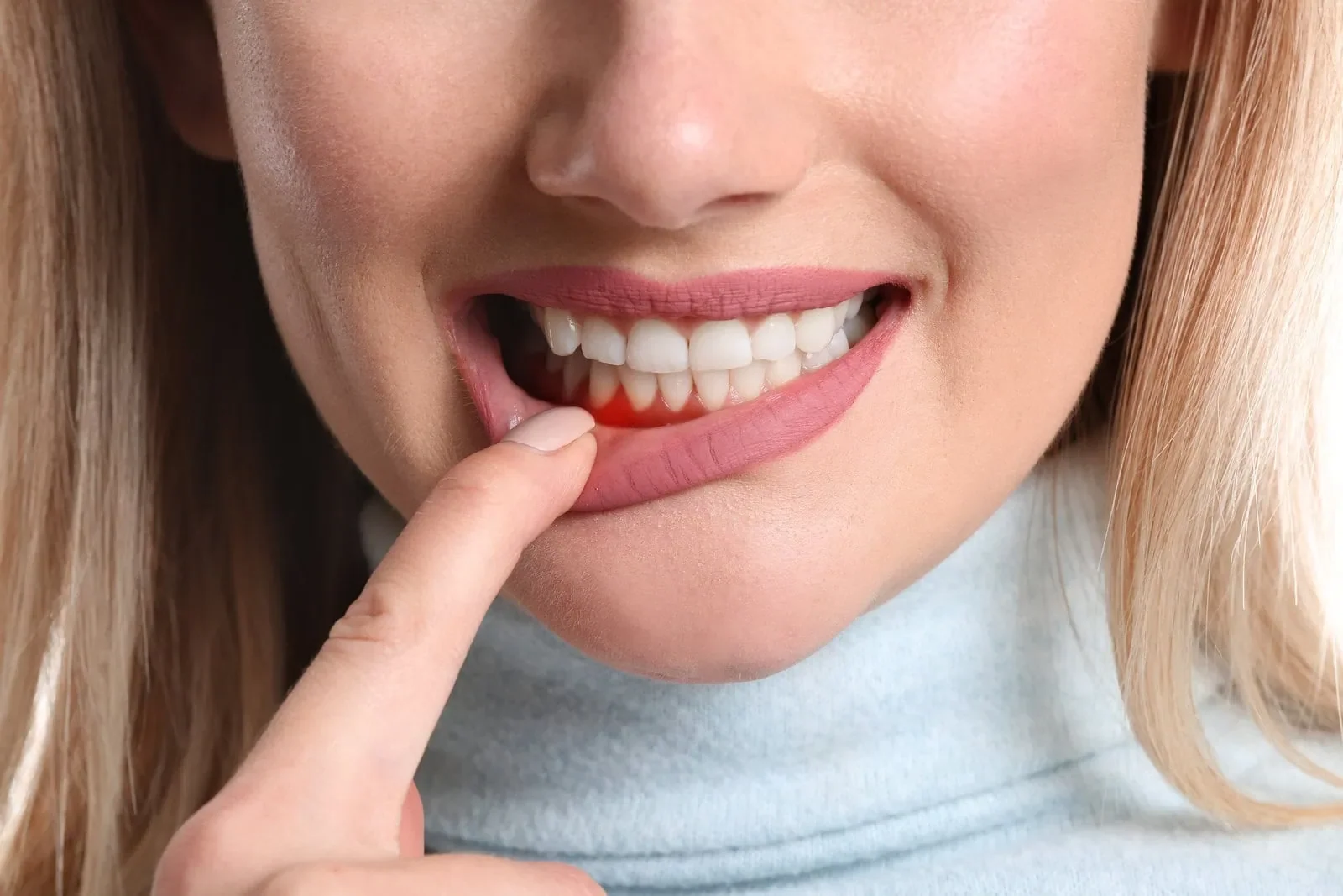 Periodontal Care at Refined Smiles